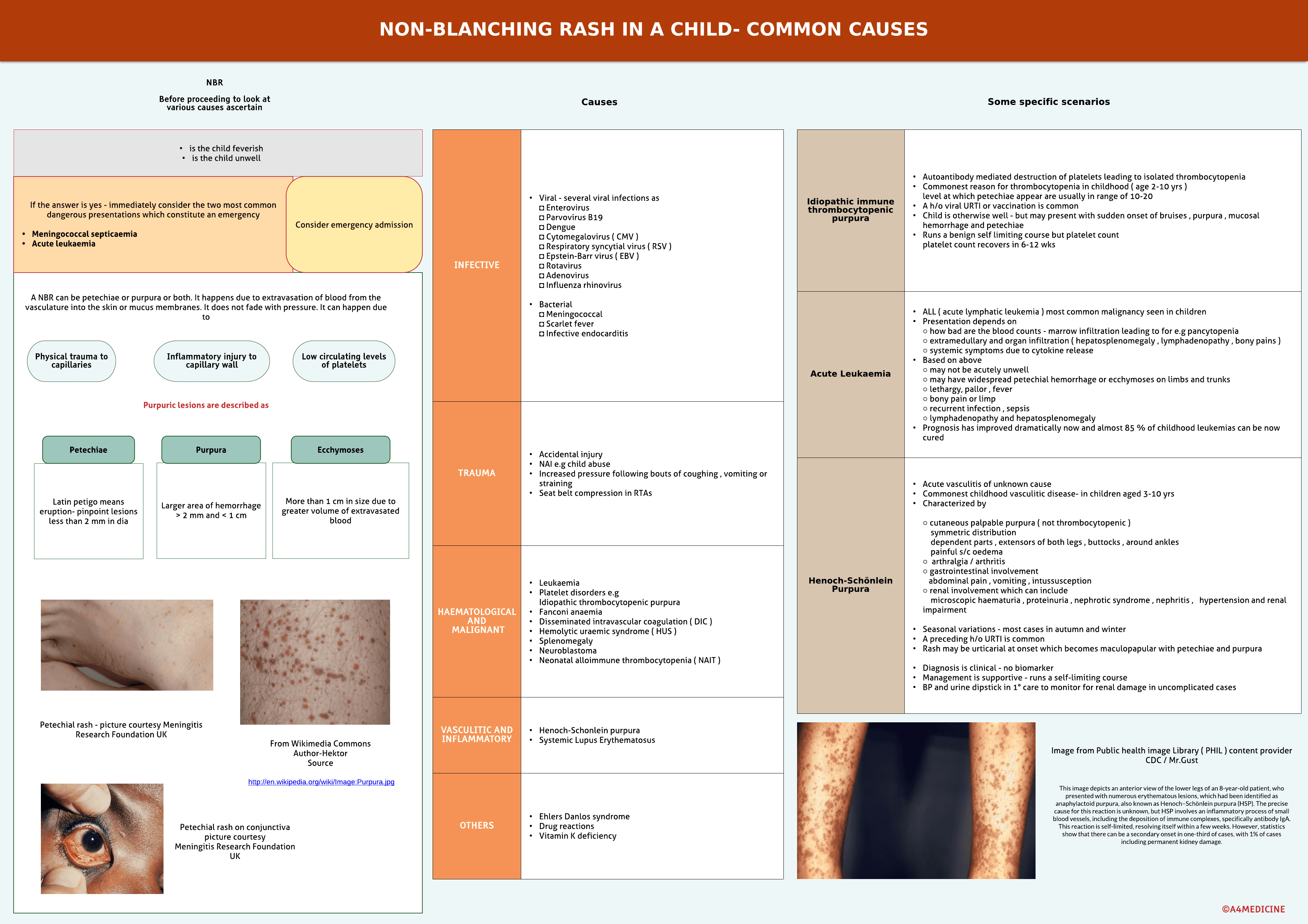 Non-blanching rash in a child