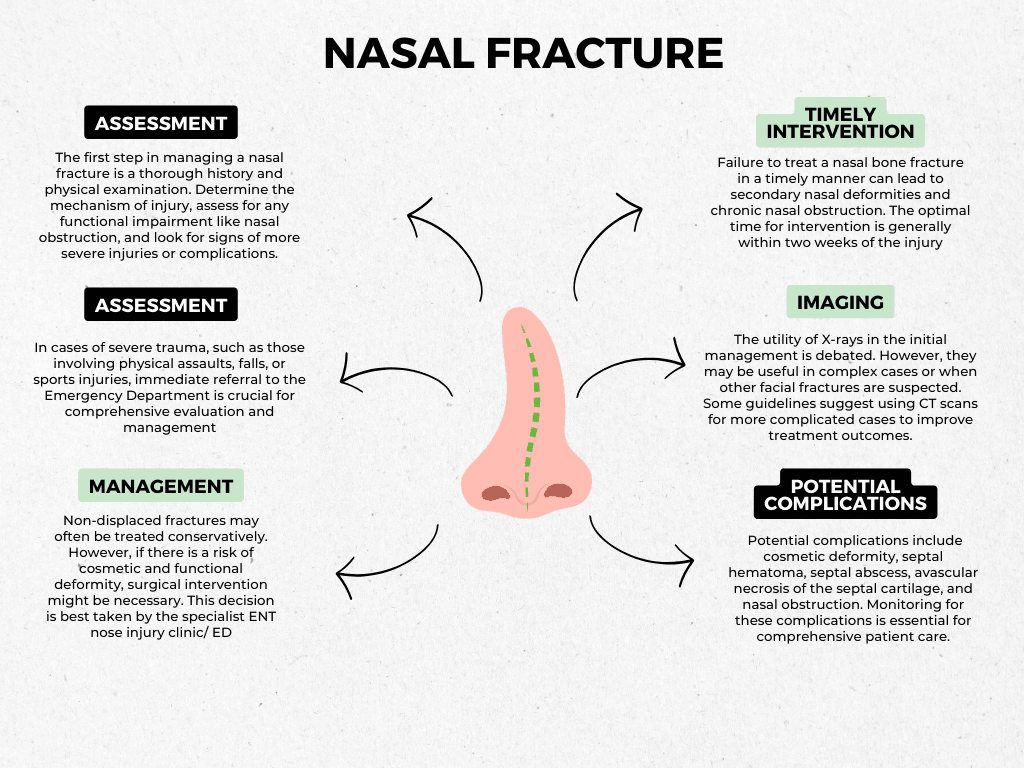 Nasal fracture